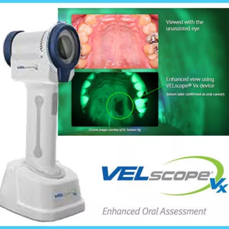 VELscope: Enhanced Oral Cancer and Mucosal Abnormality Screenings